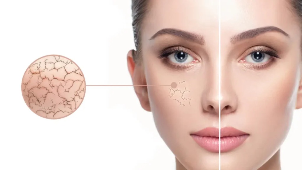 چگونه نوع پوست خود را در خانه تشخیص دهیم؟
